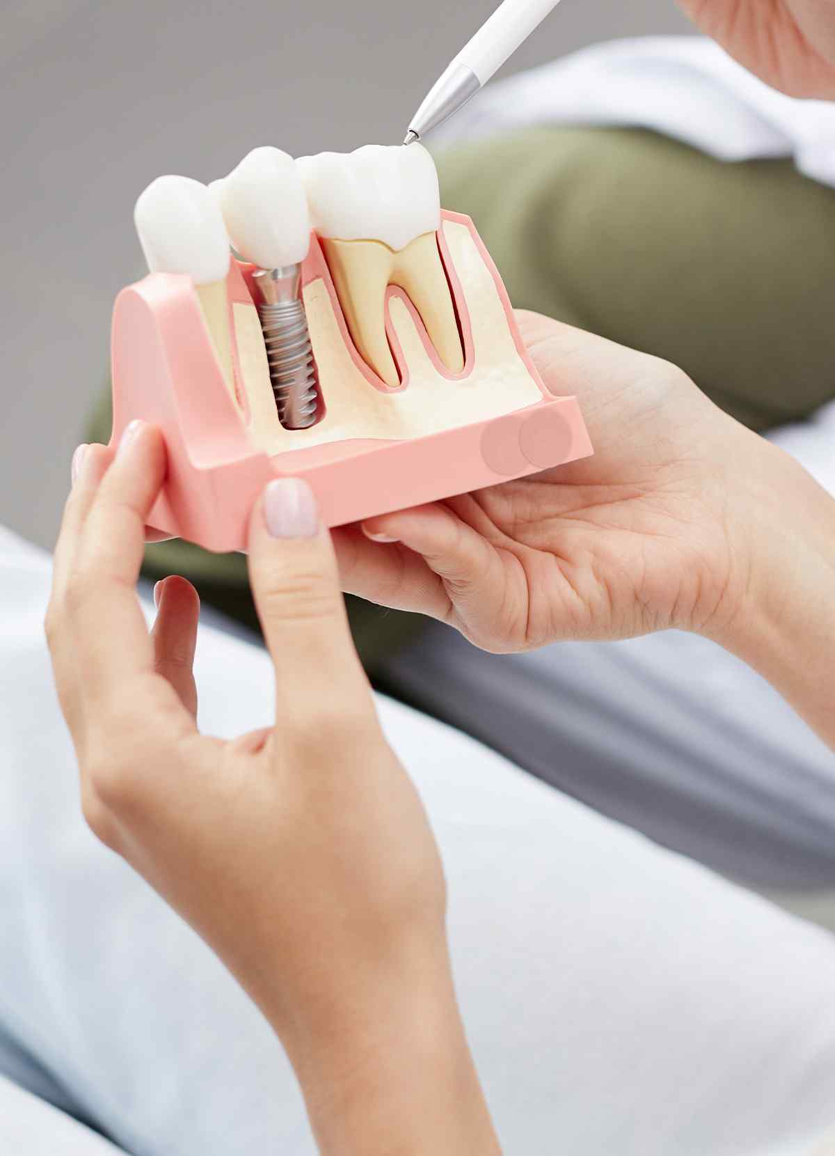 https://clients-conceptsk8.com/dentistenapierville-home/wp-content/uploads/2023/05/inner_image_03.jpg