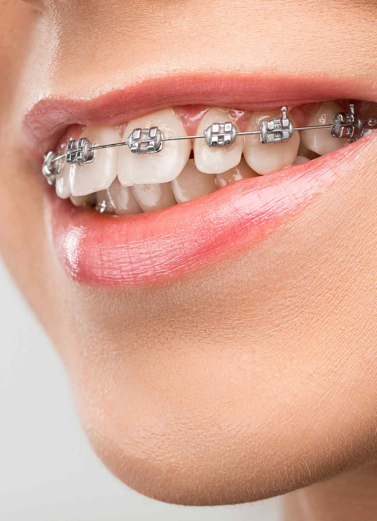 https://clients-conceptsk8.com/dentistenapierville-home/wp-content/uploads/2023/05/inner_image_04.jpg
