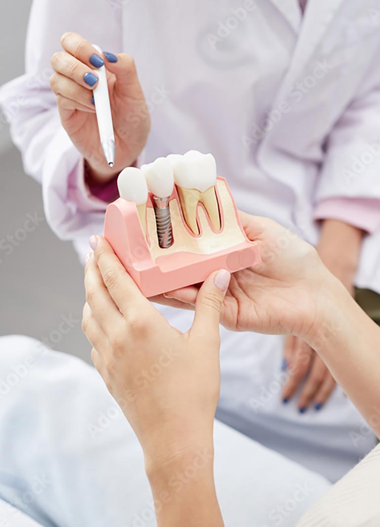 https://clients-conceptsk8.com/dentistenapierville-home/wp-content/uploads/2025/06/implant-dentaire.jpg