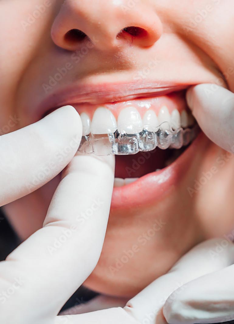 https://clients-conceptsk8.com/dentistenapierville-home/wp-content/uploads/2025/06/orthodontie-2.jpg